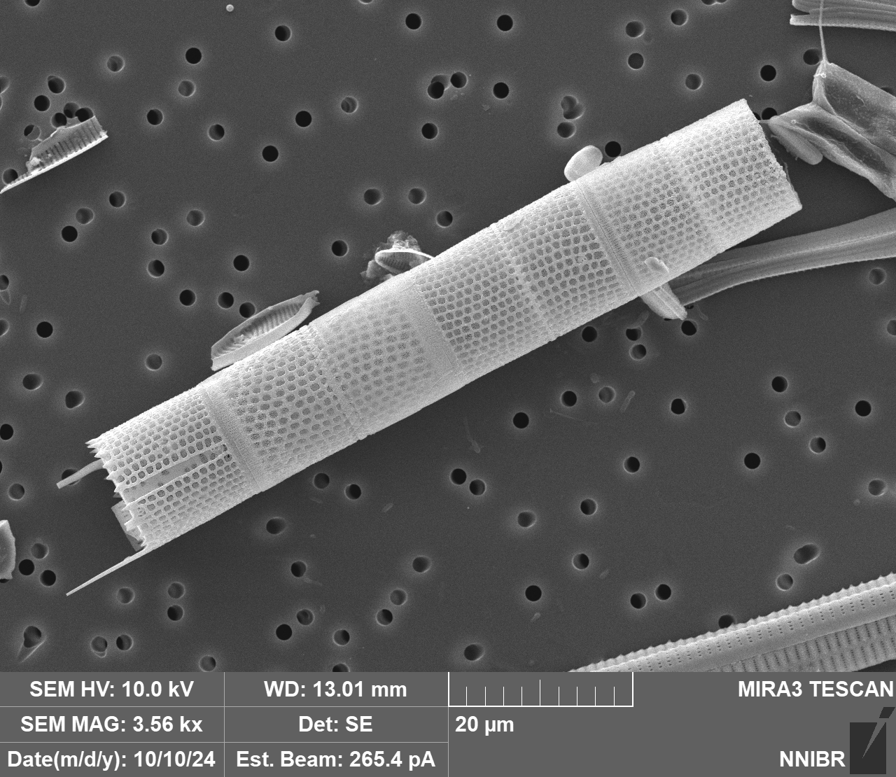 Aulacoseira muzzanensis (F. Meister) Krammer 1991