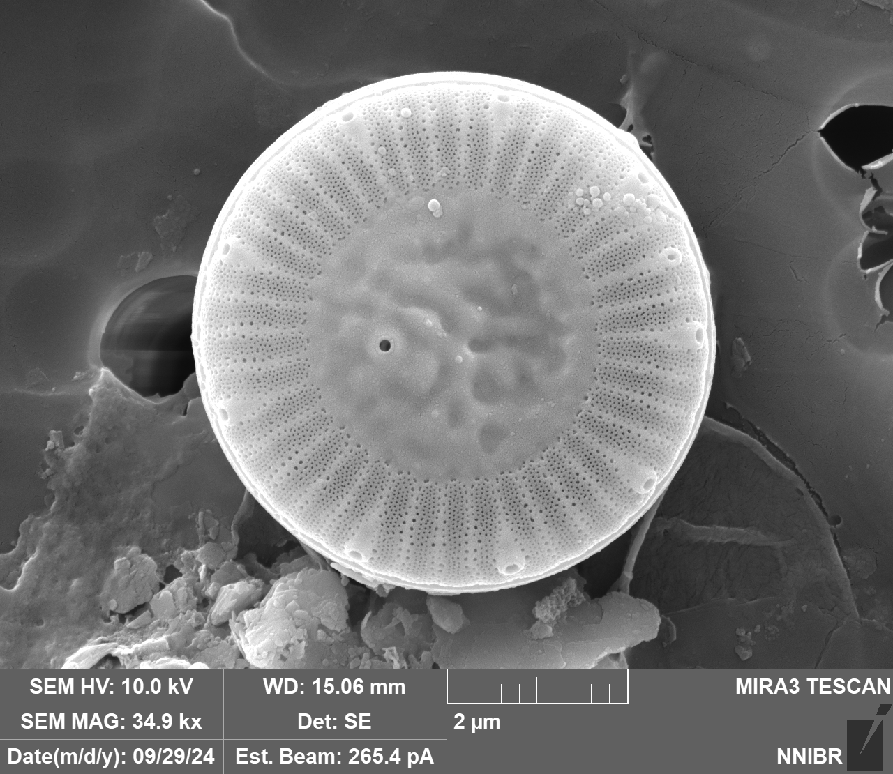 Cyclotella meneghiniana Kützing 1844